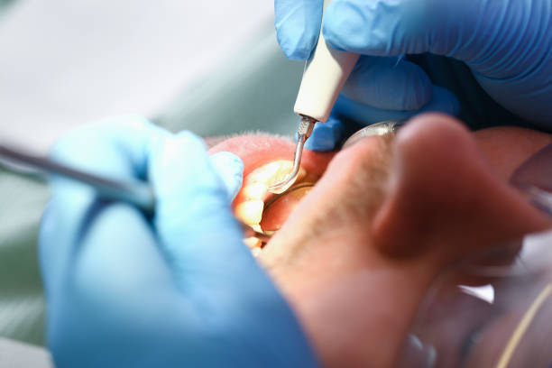 Best Broken Tooth Emergency  in Forsyth, MO