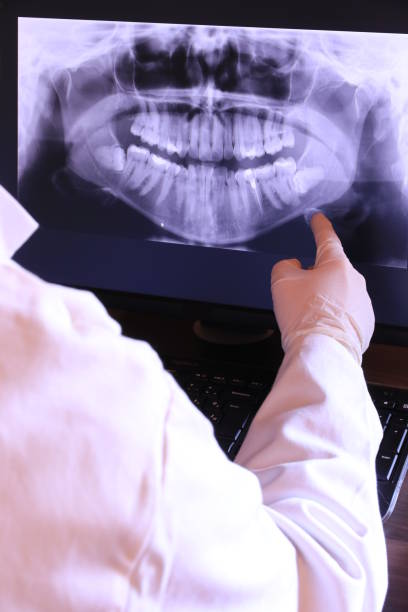 Best Tooth Infection Emergency Dentist  in Forsyth, MO