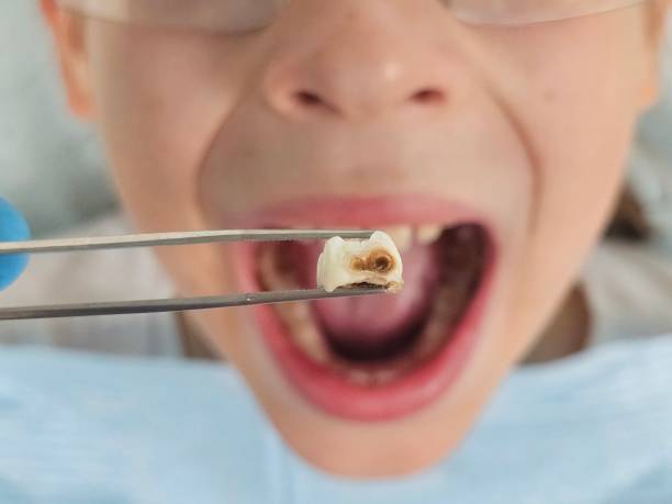 Emergency Dentist for Kids in MO